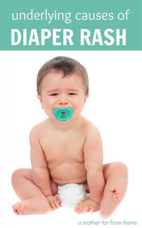 Common diaper rash causes