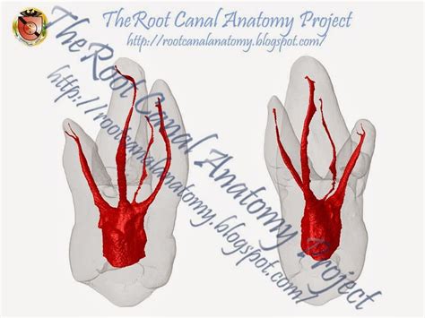 The Root Canal Anatomy Project: Maxillary First Molar: MB2