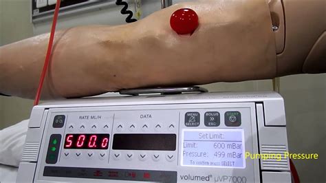 IV Infusion Pump (setting up occlusion limit) - YouTube