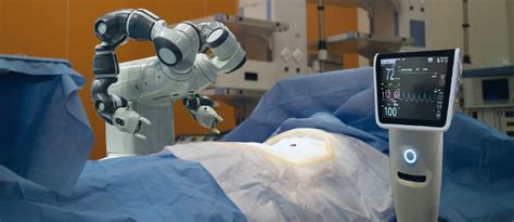 Features -- Surgical Support Robot Completes First Surgical Procedure