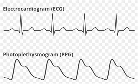 Reading The Data - Photoplethysmogram Waveform, HD Png Download - 1800x1000 (#1723088) - PinPng