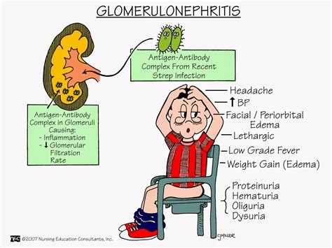 Nurses Notes: MS NURSING MNEMONICS