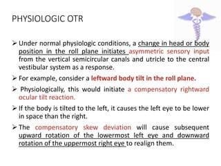 Ocular tilt reaction and skew deviation | PPT