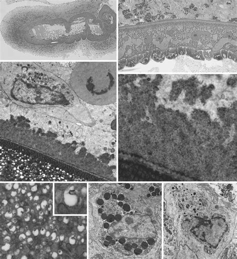 The acanthocephalan Corynosoma strumosum from the notched-fin eelpout.... | Download Scientific ...