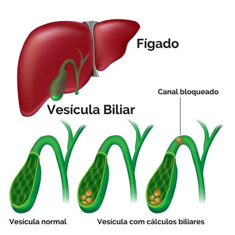 Vesícula biliar - O que é, onde fica, função, anatomia, doenças, sintomas