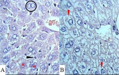 Histologic section of liver from the negative control group (A) showing... | Download Scientific ...