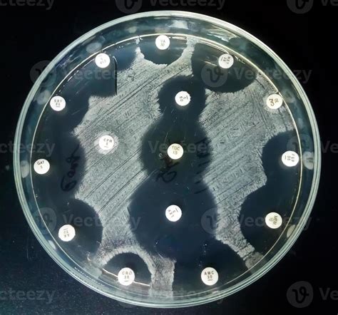 Antimicrobial susceptibility testing in petri dish. Antibiotic resistance of bacteria 4966487 ...