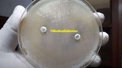 Staphylococcus saprophyticus: Introduction, Morphology, Pathogen