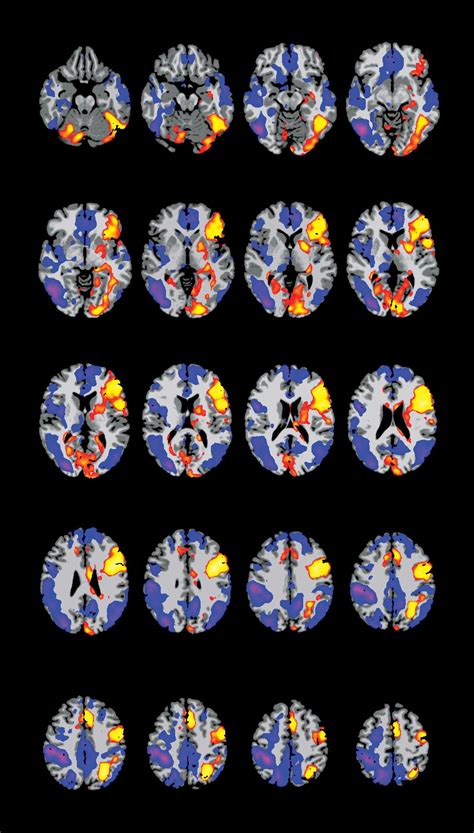 Functional mri - adminpikol