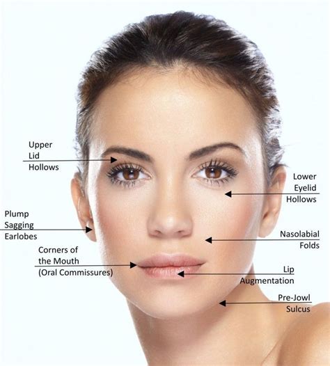 best labial fold and minor rhinoplasty with lip enhancement - Google Search | Facial aesthetics ...