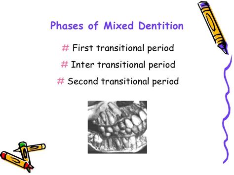 the-mixed-dentition-pedodontics