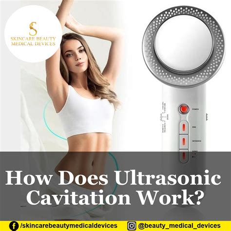 How Does Ultrasonic Cavitation Work?