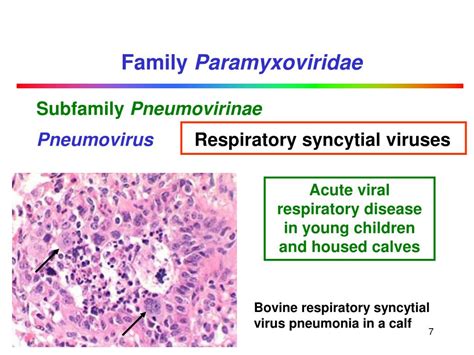 PPT - Paramyxoviridae PowerPoint Presentation, free download - ID:636320