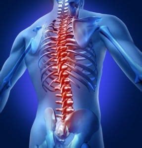 Spine Implants and How They Work - The Southeastern Spine Institute