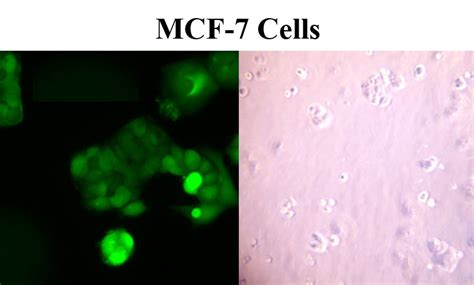 MCF-7 Cells Culture - MCF-7 Cells