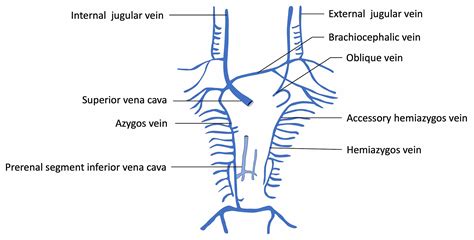 Azygos Vein