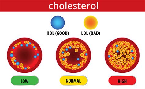 Cholesterol General 1 - Philadelphia Holistic Clinic