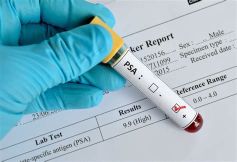 The PSA Test and Screening- Prostate Cancer Foundation