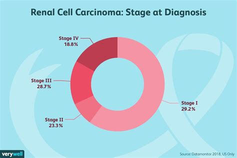 Renal Cell Carcinoma: Symptoms, Causes, Diagnosis, and Treatment