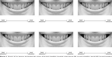 Figure 1 from Effects of buccal corridors on smile esthetics in Japanese. | Semantic Scholar