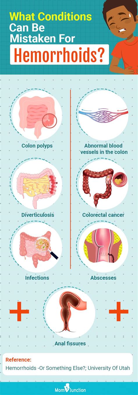 Postpartum Hemorrhoids: Symptoms, Causes, Treatments