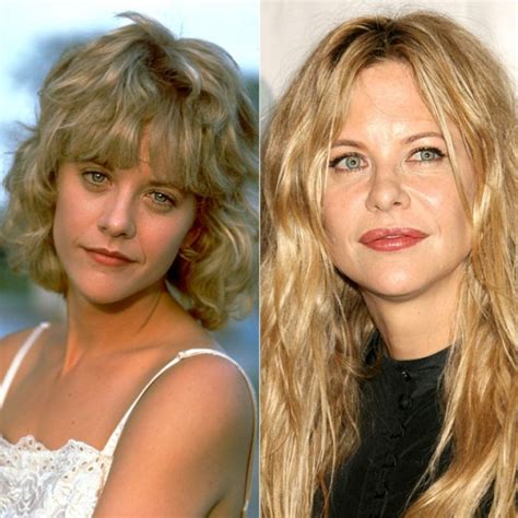 Chatter Busy: Meg Ryan Plastic Surgery Before After