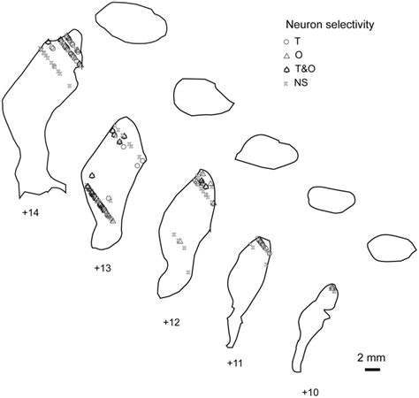 Coronal putamen slices were traced by fitting histological boundary ...