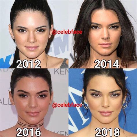 kendall jenner | Kendall jenner plastic surgery, Kendall jenner surgery, Kendall jenner makeup