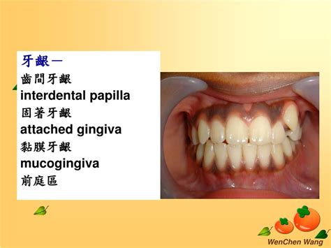 PPT - ORAL MUCOSA PowerPoint Presentation, free download - ID:482082