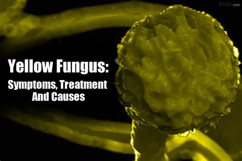 Symptoms, Prevention And Causes of Yellow Fungus, Black Fungus And ...