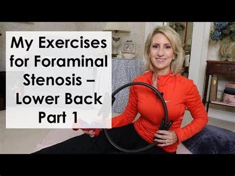 My EXERCISES for FORAMINAL STENOSIS - LOWER BACK - PART 1 - YouTube