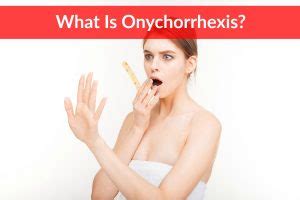 Onychorrhexis (Causes, Symptoms, Treatment) - The Healthy Apron