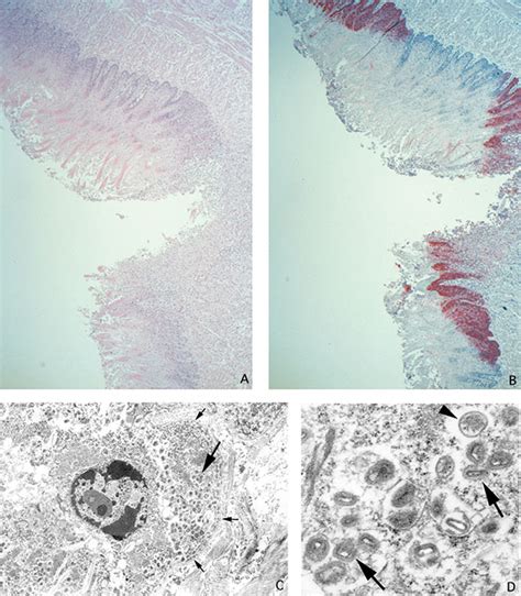 Figure 2 - Monkeypox Transmission and Pathogenesis in Prairie Dogs - Volume 10, Number 3—March ...