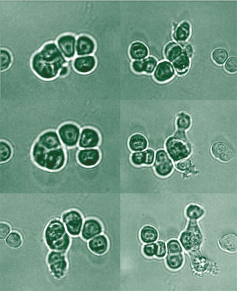 Science Is Art: Prostate cancer cells under the microscope | What's Up at Upstate | SUNY Upstate