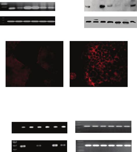 Chemokine receptors induced by stromal cells. Stromal cells were ...