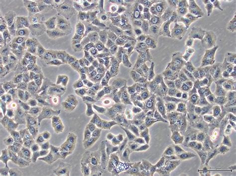 Cell culture protocols for growing human keratinocytes in the laboratory - Research Outreach