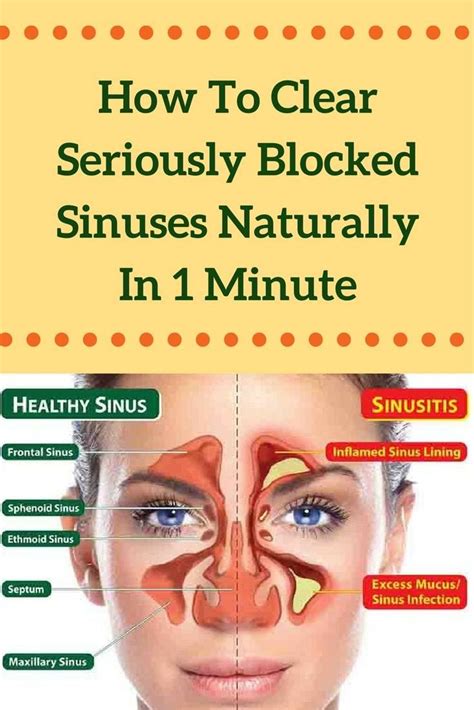 jun | Sinusitis, Blocked sinuses, Sinus health