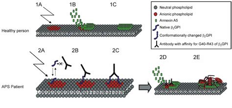 Model for a mechanism of anxA5 reduction on the surface of phospholipid ...