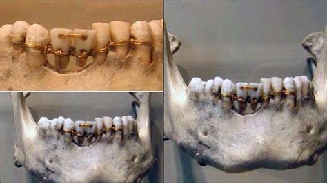 Incredible dental work found on a 4,000-year-old mummy of Ancient Egypt | The African History