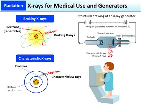 X-rays for Medical Use and Generators [MOE]