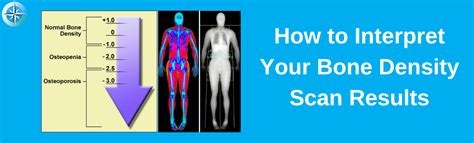 How to Interpret Your Bone Density Scan Results - True North Wellness