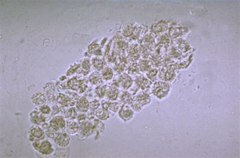 Urinalysis