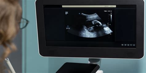 15 Reasons To Start A Career As An Ultrasound Technician