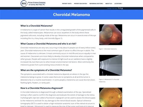 Choroidal Melanoma | Retina-Vitreous Surgeons of CNY