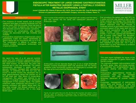 Endoscopic Treatment of Large Chronic Gastrocutaneous Fistula After ...