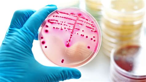 Novel Antibiotic Shown to Be Effective in Treatment of UTIs