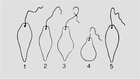 How does Euglena move? (Locomotion & Movement in Euglena)