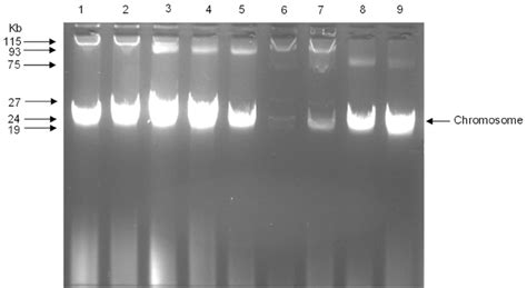 Agarose (1%) gel electrophoresis of plasmid DNA from Escherichia... | Download Scientific Diagram