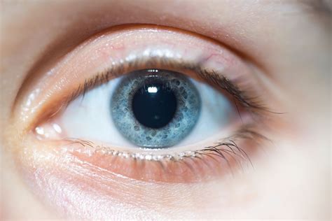 Dilated Pupils: Symptoms, Causes, and Treatment