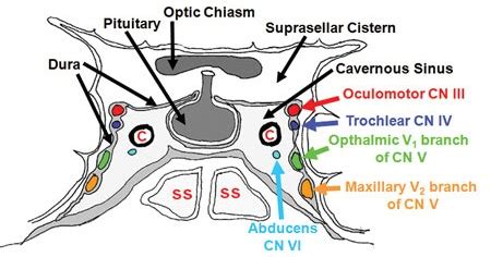 Cavernous Sinus Thrombosis-Signs symptoms-Diagnosis-Treatment and Complications | MedicoTips.Com